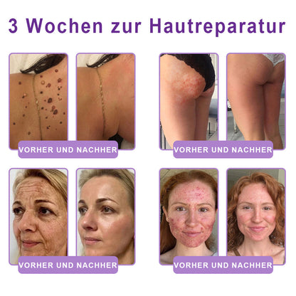 ⏰ Glückwunsch! Du hast ein exklusives Angebot freigeschaltet!  Als Dankeschön für deine Bestellung erhältst du nur heute zusätzlich 50 % Rabatt.  Klicke unten, um dir den Vorteil zu sichern – beeil dich, das Angebot läuft bald ab! ⏰