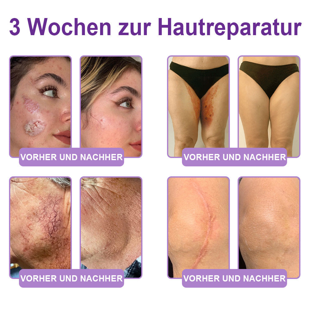 ⏰ Glückwunsch! Du hast ein exklusives Angebot freigeschaltet!  Als Dankeschön für deine Bestellung erhältst du nur heute zusätzlich 50 % Rabatt.  Klicke unten, um dir den Vorteil zu sichern – beeil dich, das Angebot läuft bald ab! ⏰