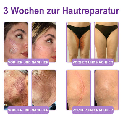 ⏰ Glückwunsch! Du hast ein exklusives Angebot freigeschaltet!  Als Dankeschön für deine Bestellung erhältst du nur heute zusätzlich 50 % Rabatt.  Klicke unten, um dir den Vorteil zu sichern – beeil dich, das Angebot läuft bald ab! ⏰